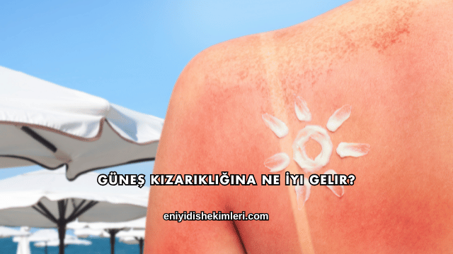 Güneş Kızarıklığına Ne İyi Gelir?