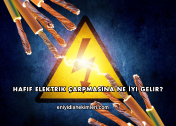 Hafif Elektrik Çarpmasına Ne İyi Gelir?