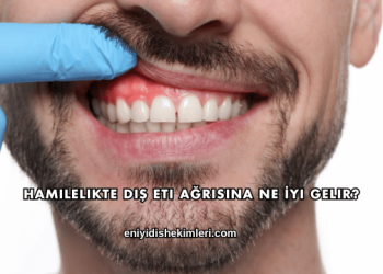 Hamilelikte Diş Eti Ağrısına Ne İyi Gelir?