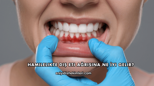 Hamilelikte Diş Eti Ağrısına Ne İyi Gelir?