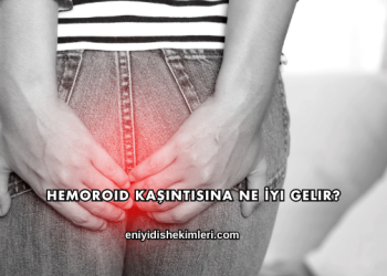 Hemoroid Kaşıntısına Ne İyi Gelir?