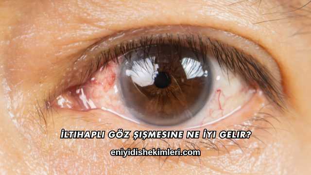 İltihaplı Göz Şişmesine Ne İyi Gelir?
