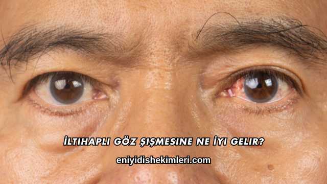 İltihaplı Göz Şişmesine Ne İyi Gelir?