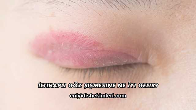 İltihaplı Göz Şişmesine Ne İyi Gelir?