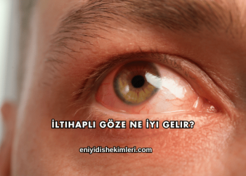 İltihaplı Göze Ne İyi Gelir?