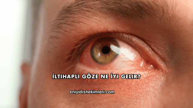 İltihaplı Göze Ne İyi Gelir?