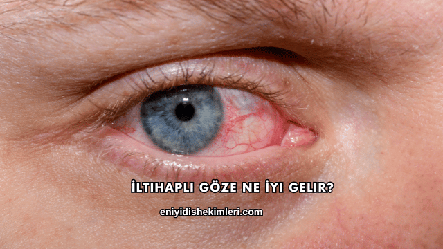 İltihaplı Göze Ne İyi Gelir?