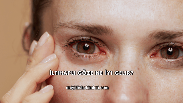İltihaplı Göze Ne İyi Gelir?