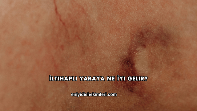 İltihaplı Yaraya Ne İyi Gelir?