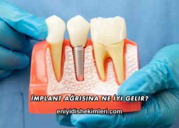 İmplant Ağrısına Ne İyi Gelir?