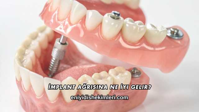 İmplant Ağrısına Ne İyi Gelir?