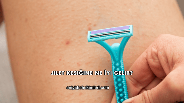 Jilet Kesiğine Ne İyi Gelir?