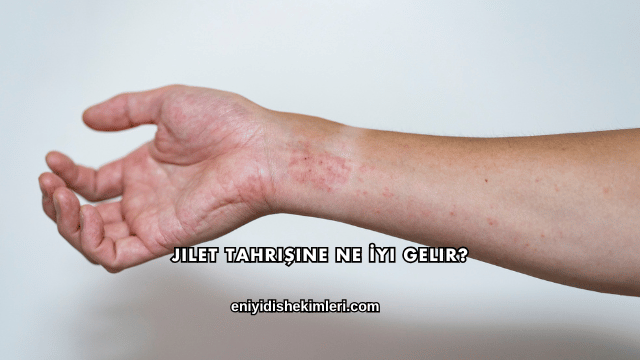 Jilet Tahrişine Ne İyi Gelir?