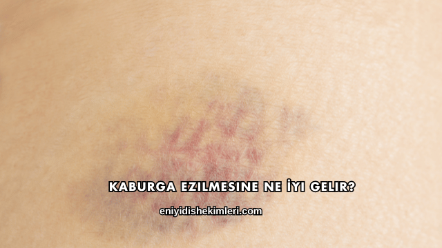 Kaburga Ezilmesine Ne İyi Gelir?