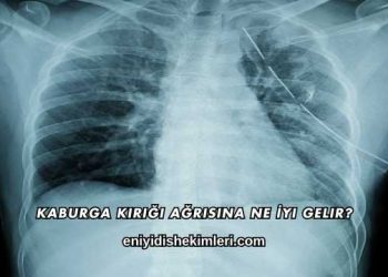 Kaburga Kırığı Ağrısına Ne İyi Gelir?