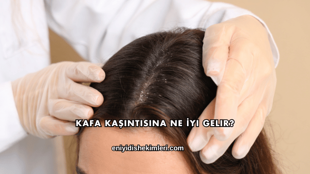Kafa Kaşıntısına Ne İyi Gelir?