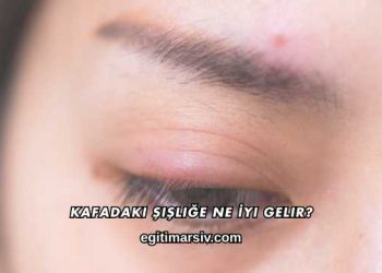 Kafadaki Şişliğe Ne İyi Gelir?