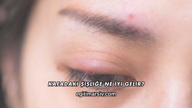 Kafadaki Şişliğe Ne İyi Gelir?