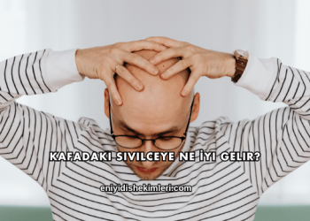 Kafadaki Sivilceye Ne İyi Gelir?