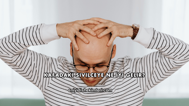Kafadaki Sivilceye Ne İyi Gelir?