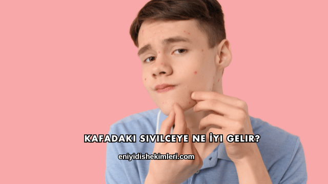 Kafadaki Sivilceye Ne İyi Gelir?
