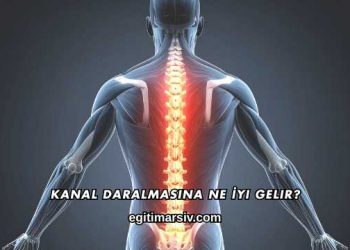 Kanal Daralmasına Ne İyi Gelir?