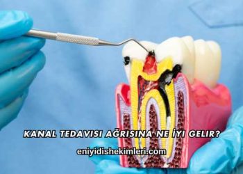 Kanal Tedavisi Ağrısına Ne İyi Gelir?