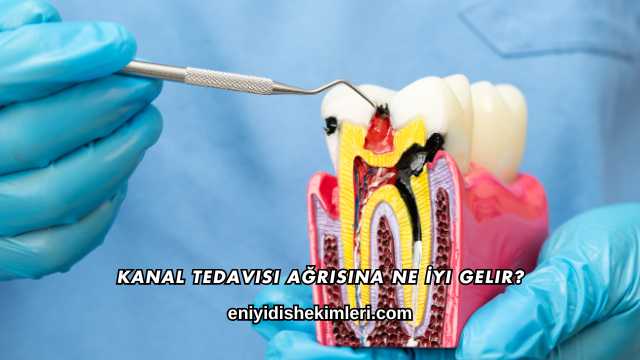 Kanal Tedavisi Ağrısına Ne İyi Gelir?