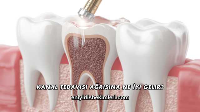 Kanal Tedavisi Ağrısına Ne İyi Gelir?