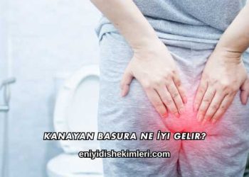Kanayan Basura Ne İyi Gelir?