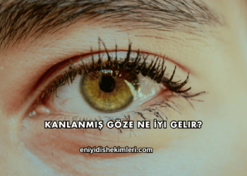 Kanlanmış Göze Ne İyi Gelir?