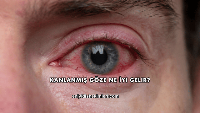 Kanlanmış Göze Ne İyi Gelir?