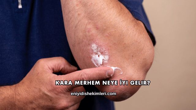 Kara Merhem Neye İyi Gelir?