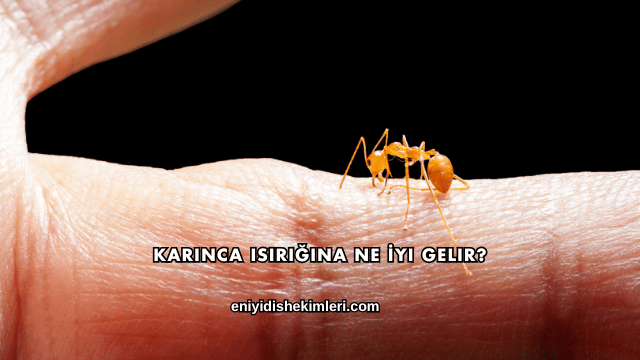 Karınca Isırığına Ne İyi Gelir?