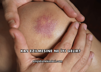 Kas Ezilmesine Ne İyi Gelir?