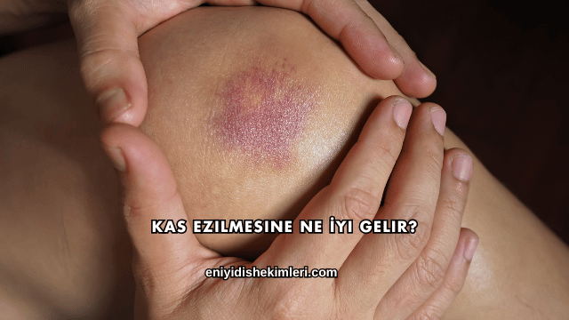 Kas Ezilmesine Ne İyi Gelir?