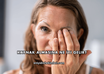 Kaynak Almasına Ne İyi Gelir?