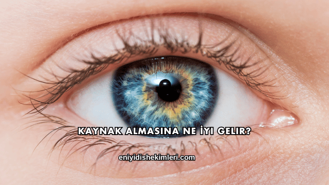 Kaynak Almasına Ne İyi Gelir?