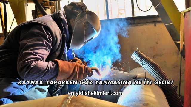 Kaynak Yaparken Göz Yanmasına Ne İyi Gelir?