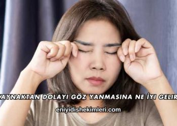 Kaynaktan Dolayı Göz Yanmasına Ne İyi Gelir?