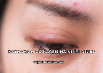 Kaynaktan Göz Ağrısına Ne İyi Gelir?