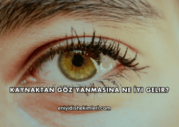 Kaynaktan Göz Yanmasına Ne İyi Gelir?