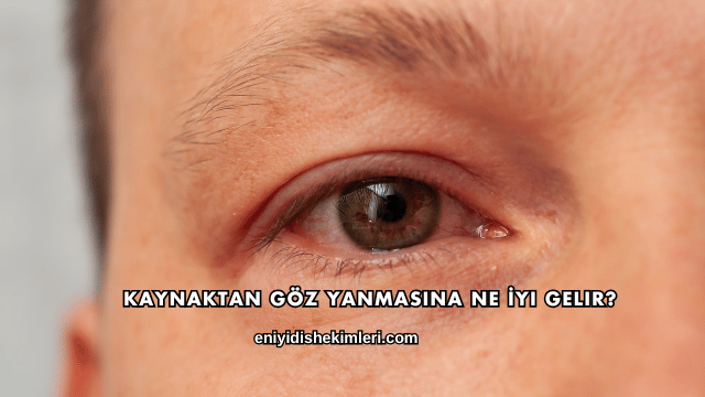 Kaynaktan Göz Yanmasına Ne İyi Gelir?