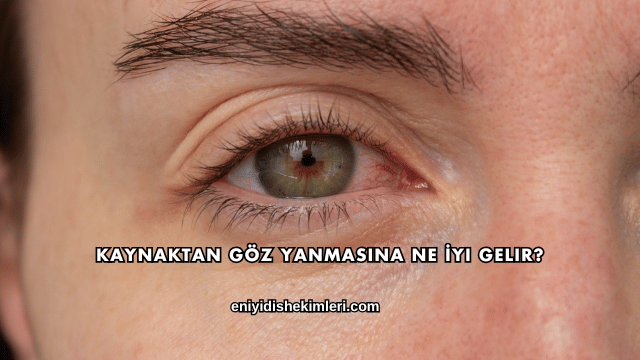 Kaynaktan Göz Yanmasına Ne İyi Gelir?