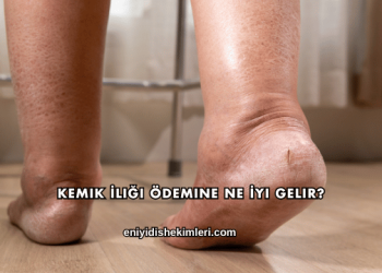 Kemik İliği Ödemine Ne İyi Gelir?