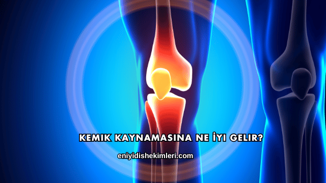 Kemik Kaynamasına Ne İyi Gelir?