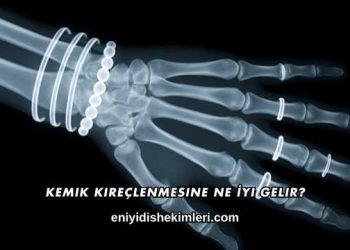 Kemik Kireçlenmesine Ne İyi Gelir?