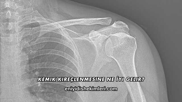 Kemik Kireçlenmesine Ne İyi Gelir?