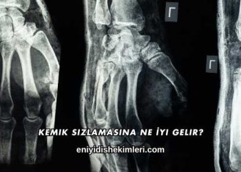 Kemik Sızlamasına Ne İyi Gelir?