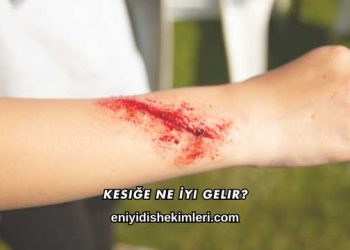 Kesiğe Ne İyi Gelir?